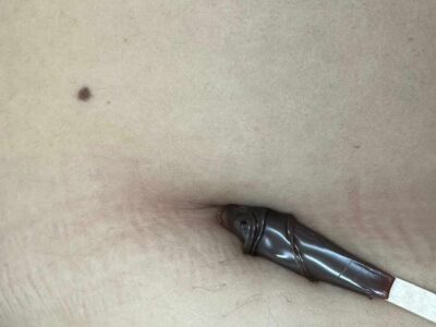 depilacion femenina con cera española en guadalajara | ombligo mujer