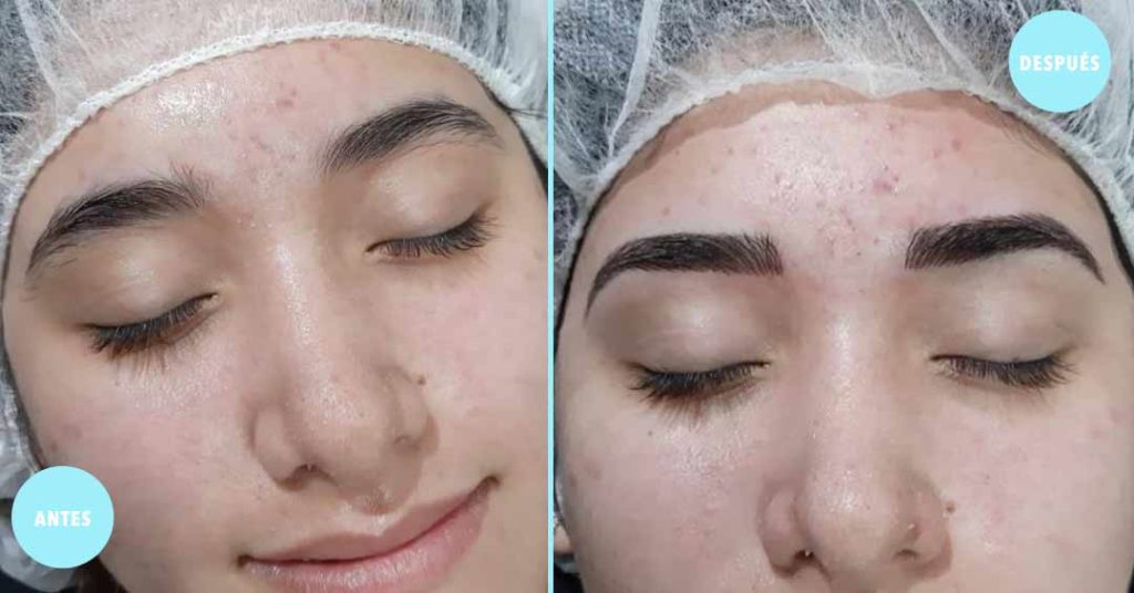 microblading en guadalajara 1 antes y despues