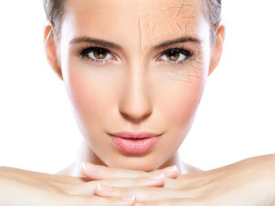 sublimacion de piel para rejuvencer | trataminentos rejuvenecedores guadalajara | spa en guadalajara