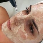 Qué Hacer Después del BB Glow con Dermapen en Guadalajara | Faciales Guadalajara