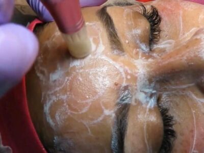 bb glow en guadalajara con dermapen | spa en guadalajara