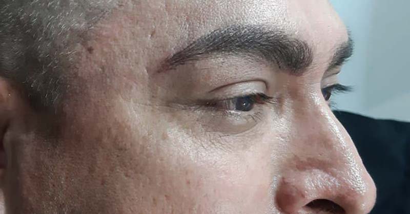 microbalding pelo a pelo para hombres resultados | cejas pelo a pelo en guadalajara | spas en guadalajara