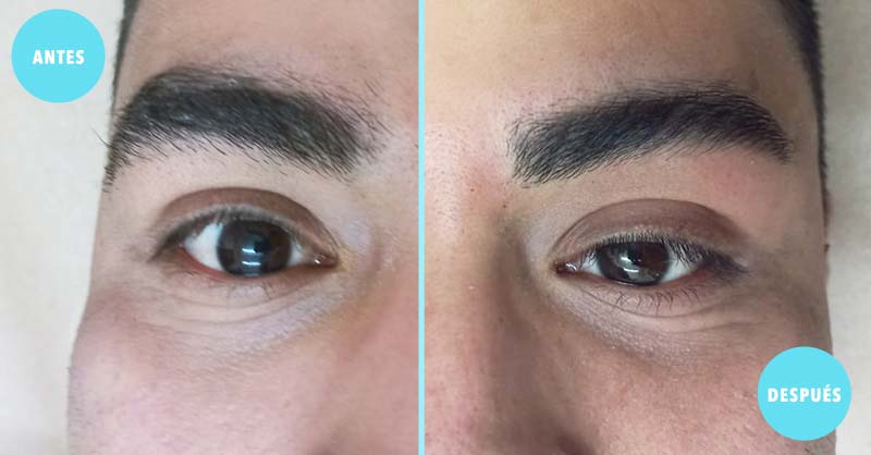 diseño de cejas con cera antes y despues | depilacion masculina de cejas | spas guadalajara