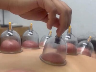 masajes con ventosas en Guadalajara | Spa Guadalajara