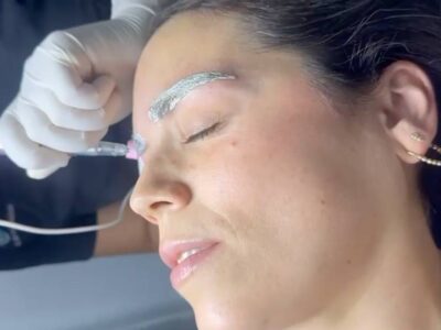 Eliminacion de tatuajes en guadalajara | recomocion de tatauajes faciales en guadalajara | spa guadalajara