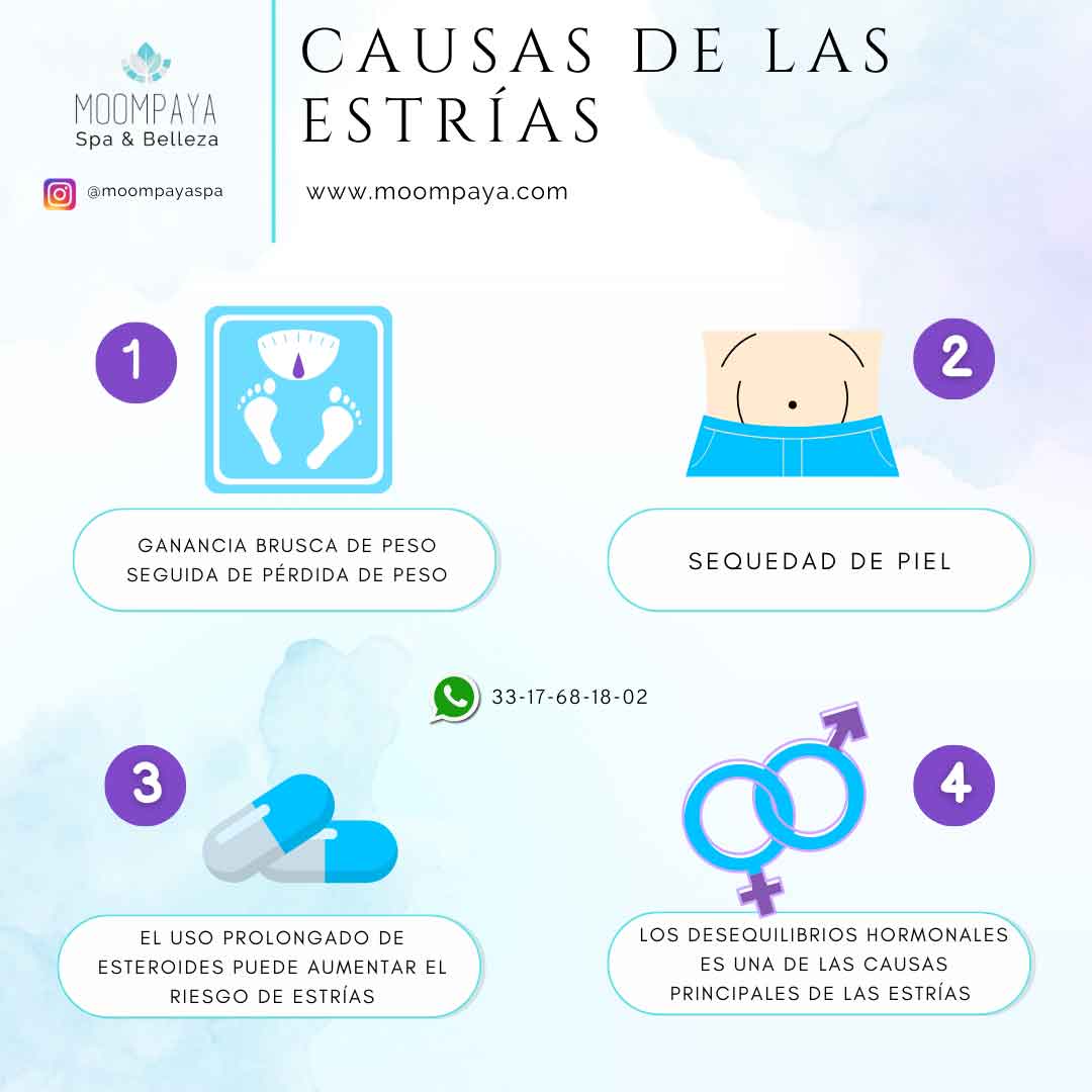 causas de las estrias | tratamientos para estrias | spa guadalajara