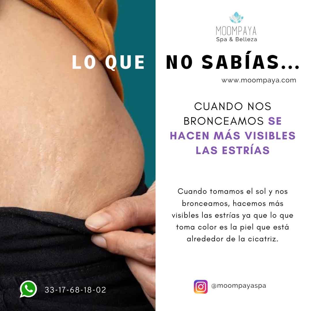 causas de las estrias | tsabias que | spa en guadalajara