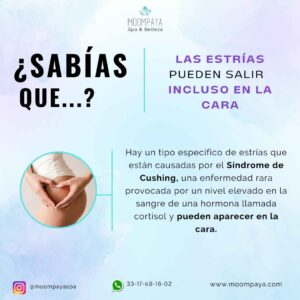 porque salen estrias | tratamientos para estrias | spa en guadalajara