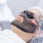 hollywood peel facial en guadalajara | spas en guadalajara